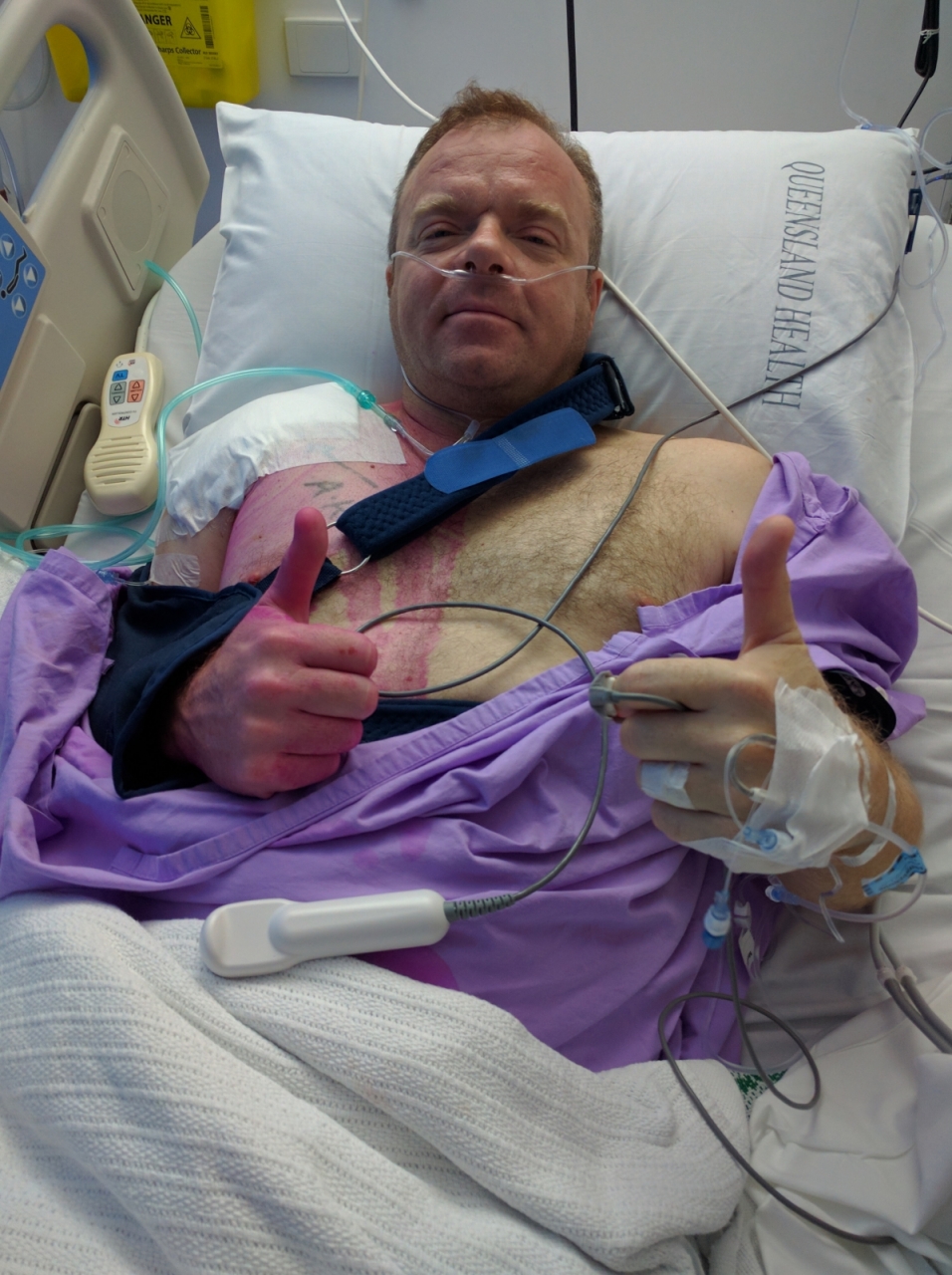 Shoulder Rebuild  -  Wear your safety gear! If i wore my elbow pas i would've slid,  not...